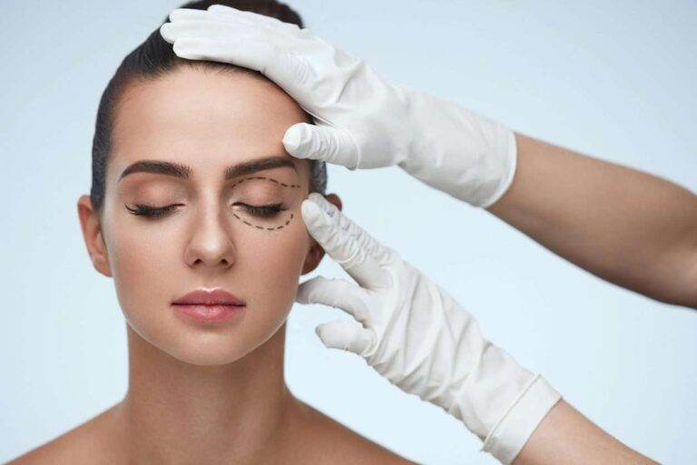 What is Eye Bag Surgery, Lower Lid Blepharoplasty?