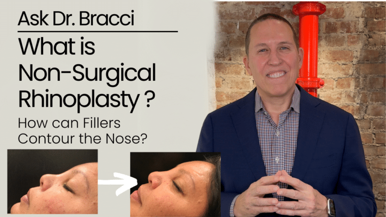 What is Non-Surgical Rhinoplasty and How can Fillers Contour the Nose?