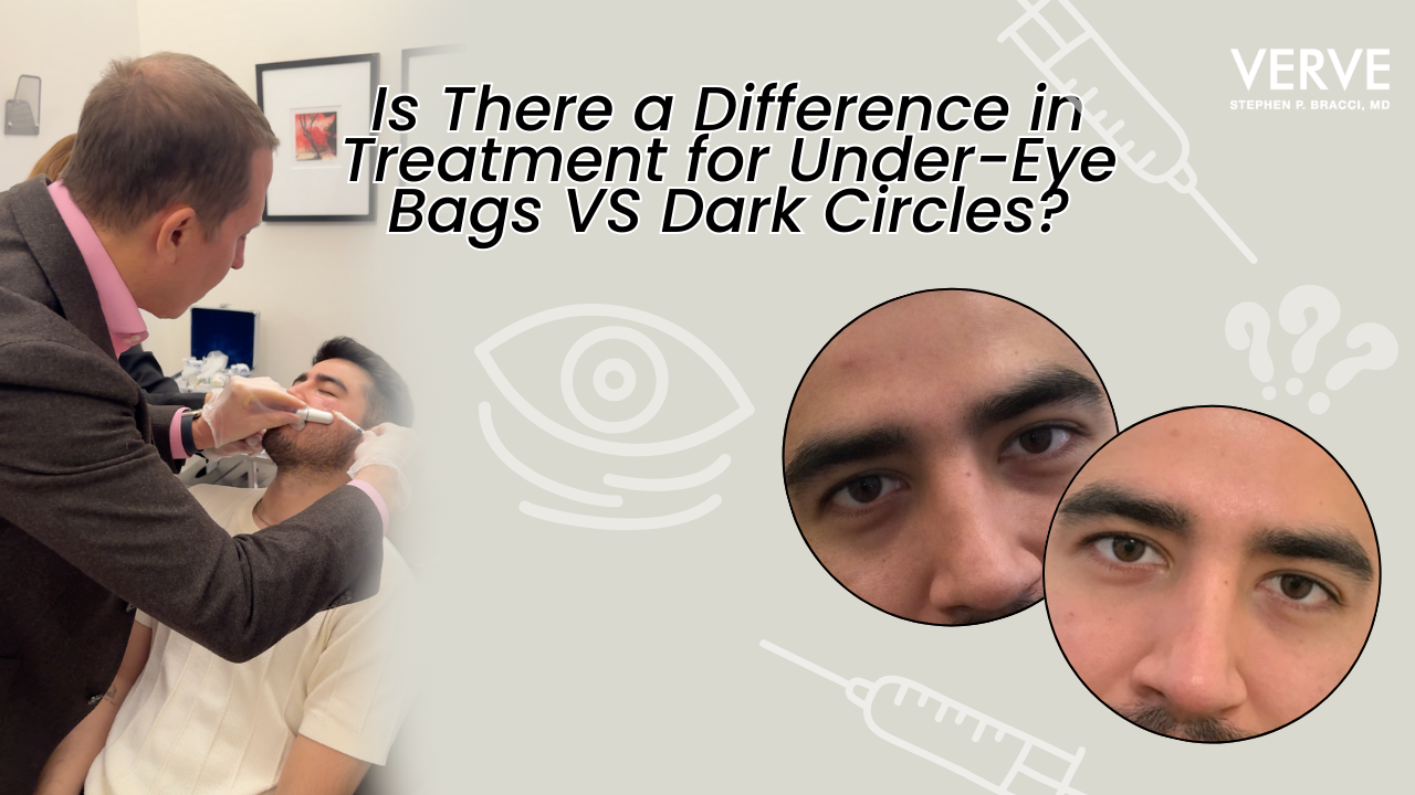 Different Treatment Options For UnderEye Bags Vs Dark Circles?