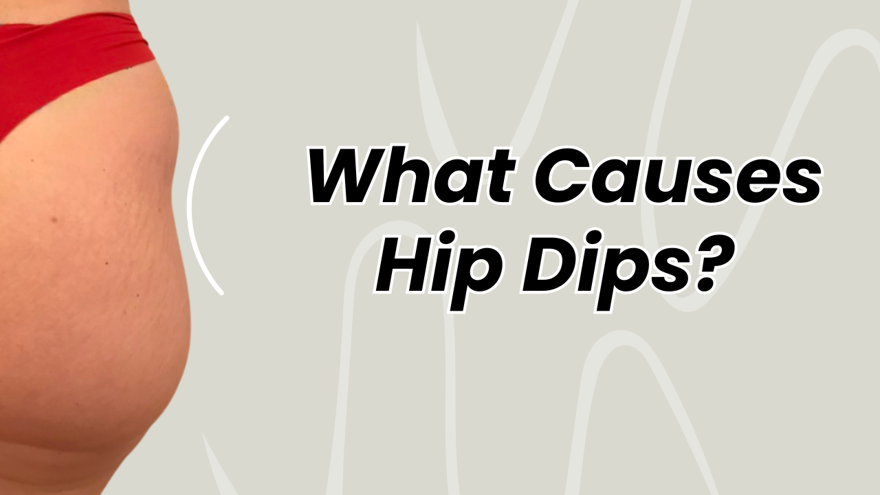 Unveiling The Mysteries Behind Hip Dips What Causes Hip Dips